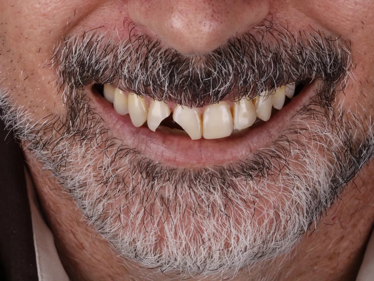 Reabilitação Estética — situação antes do tratamento