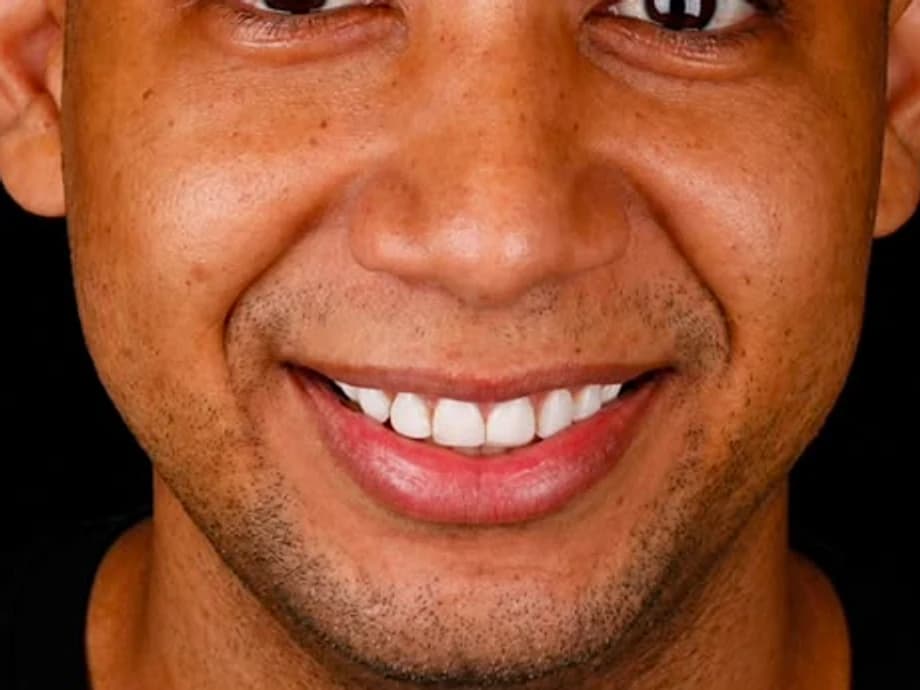 Transformação do Sorriso — situação antes do tratamento