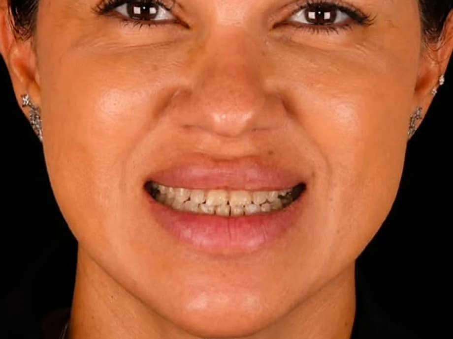 Transformação do Sorriso — situação antes do tratamento