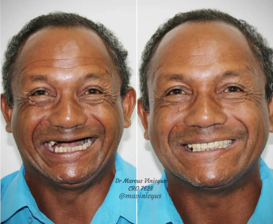 Caso clínico do início da trajetória do Dr. Marcus Vinicyus